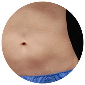 cs-tretmnt-pln-3 cs-tretmnt-pln-3